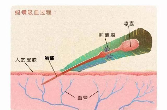 如果水蛭接触到沙子会怎么样,如果水蛭钻人血管会怎样