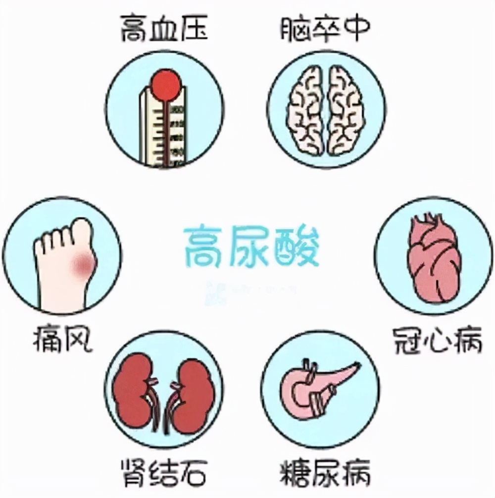 尿酸486吃非布司他20mg还是40mg,吃非布司他真的可以降尿酸吗