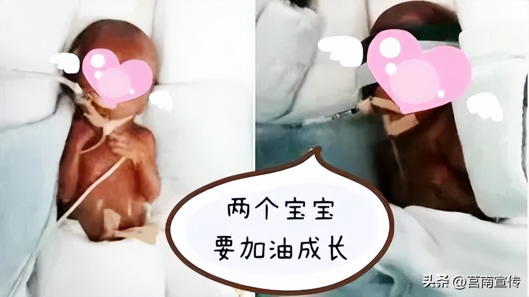 早产儿体重2斤能存活吗,不到两斤的早产儿能存活吗