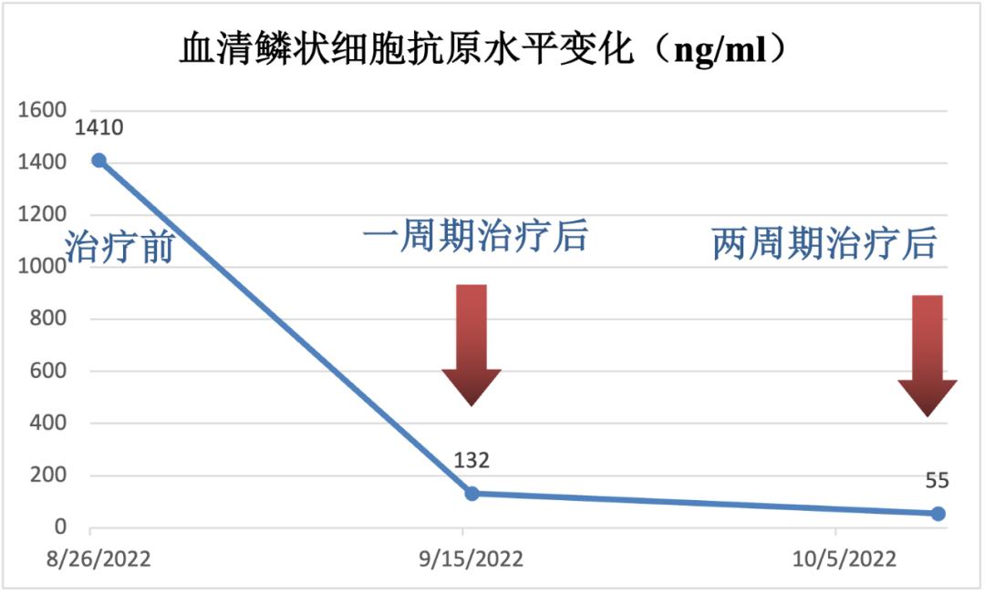 外阴鳞癌放疗后复发还能活多久,宫颈鳞癌化疗后病灶没缩小