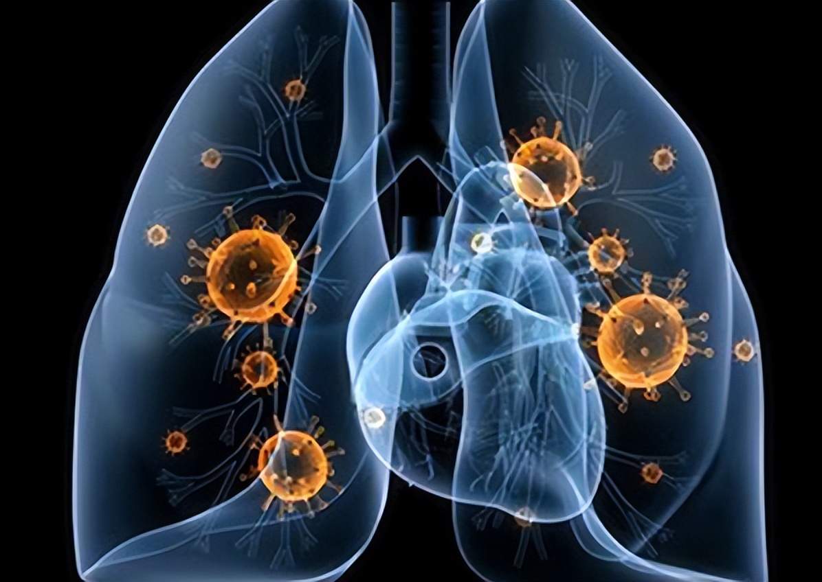 阿莫西林列入十种不能吃的药,阿莫西林别乱吃只对6种病有效