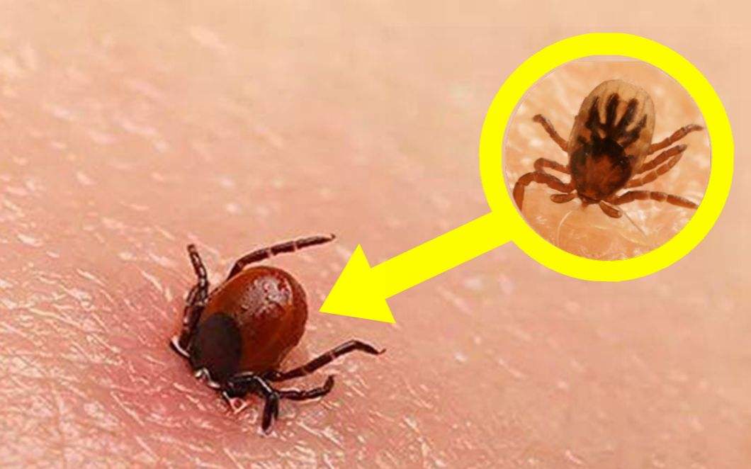 当心蜱虫,蜱虫该怎么避免