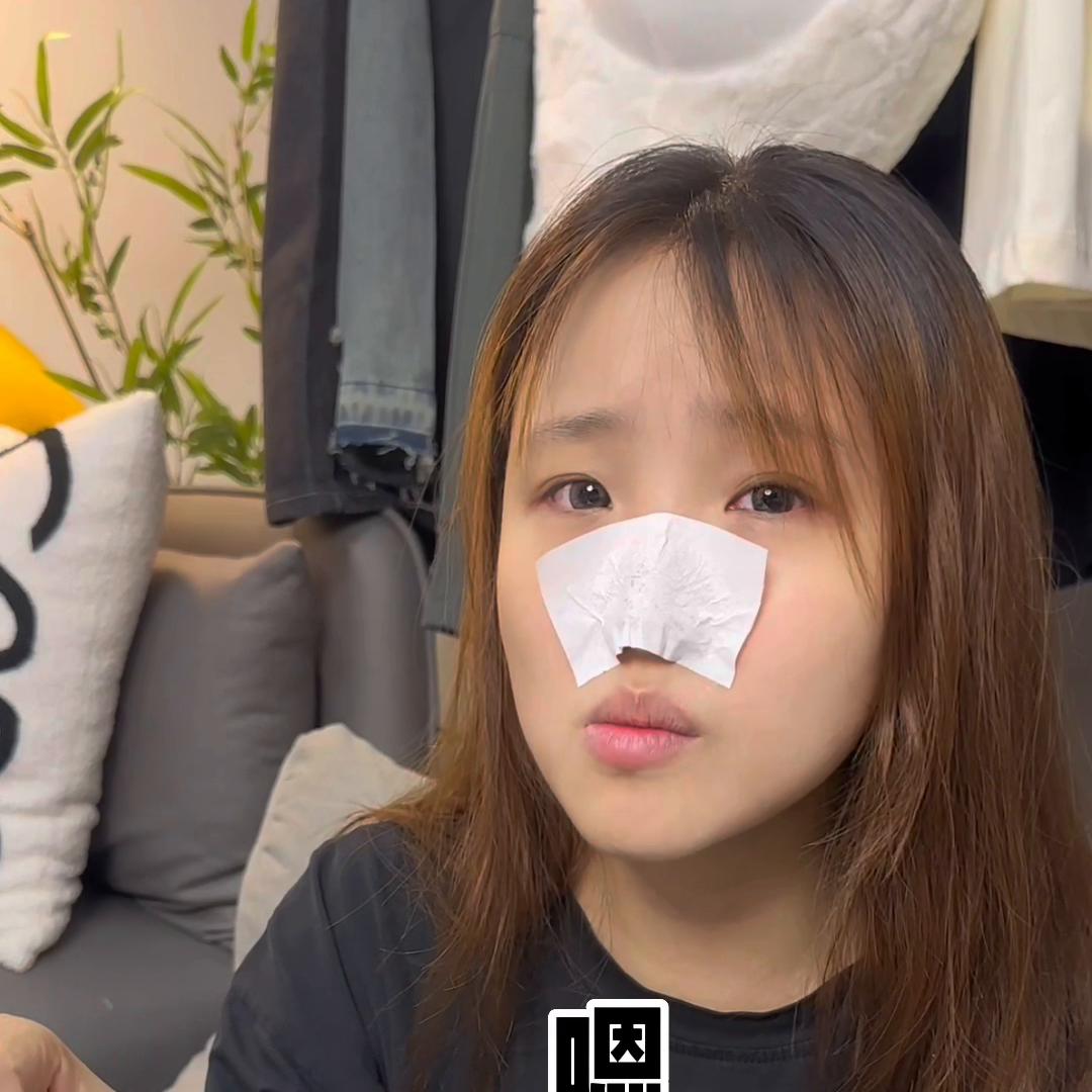 草莓鼻清理黑头神器大牌试用装,清理黑头草莓鼻最有效的方法