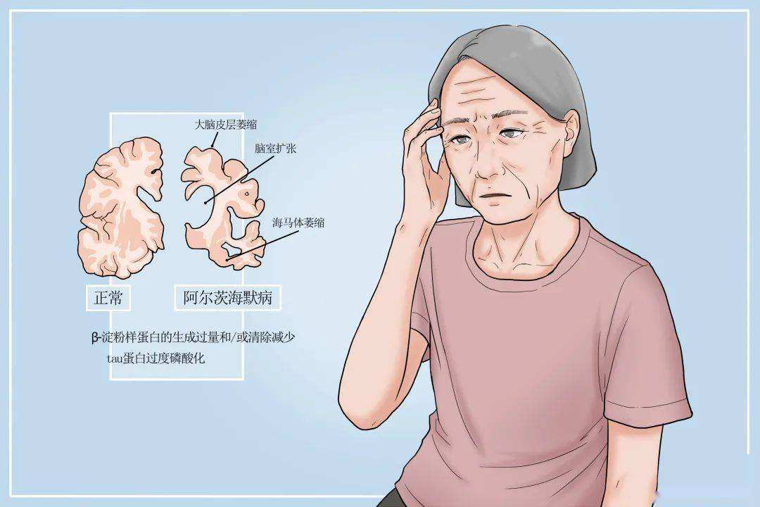 预防老年痴呆补充叶酸有效吗,维生素b12和叶酸适合脑梗病人吗