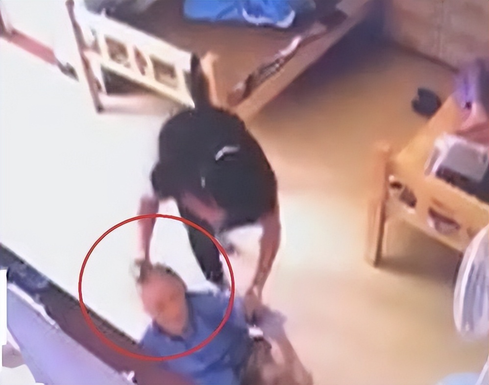 老兵被养老院护工打爆眼球,73岁老人被养老院护工打爆眼球