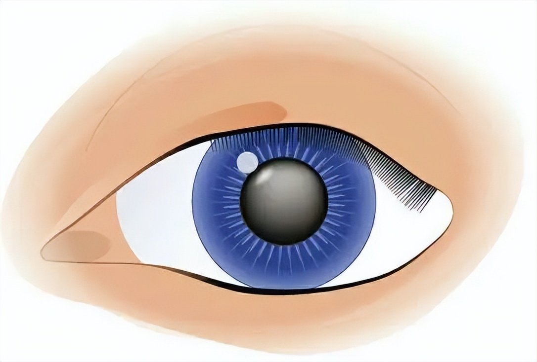 白内障久拖不治成弱视,白内障一直不做手术有什么后果