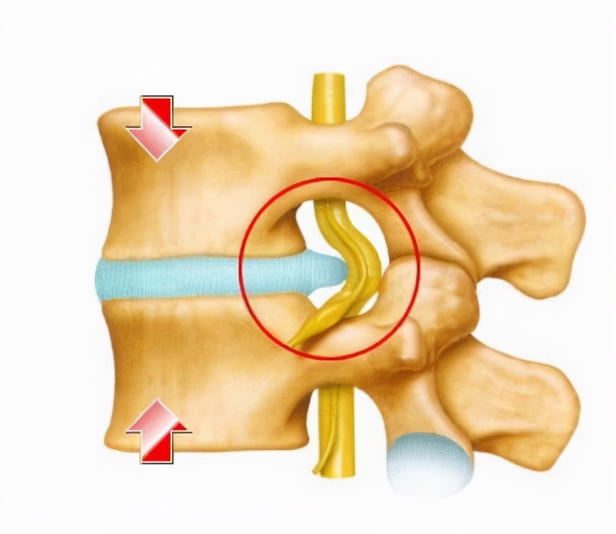 一味中药祛湿止痛最好,强筋壮骨健脾祛湿最好的中药