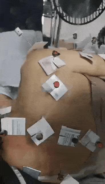 我有肩周炎晚上很疼怎么治,大活络丸治肩周炎效果怎样