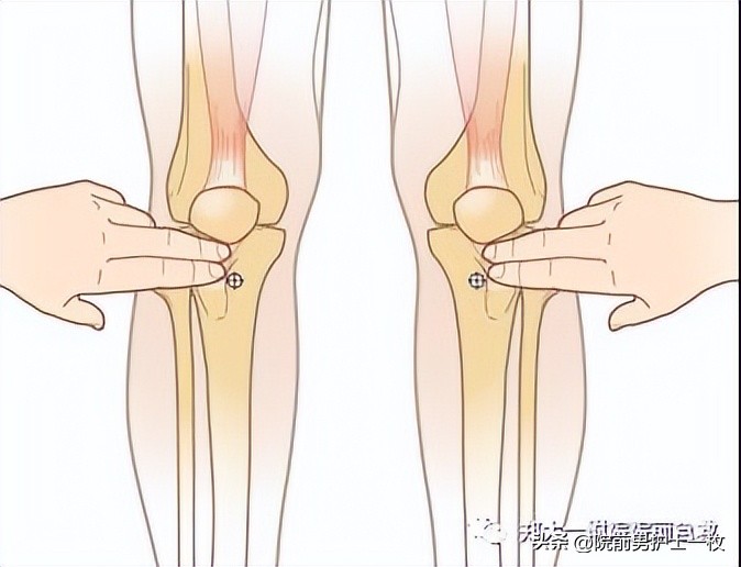 骨髓腔穿刺急救,骨髓腔穿刺适应症和禁忌症