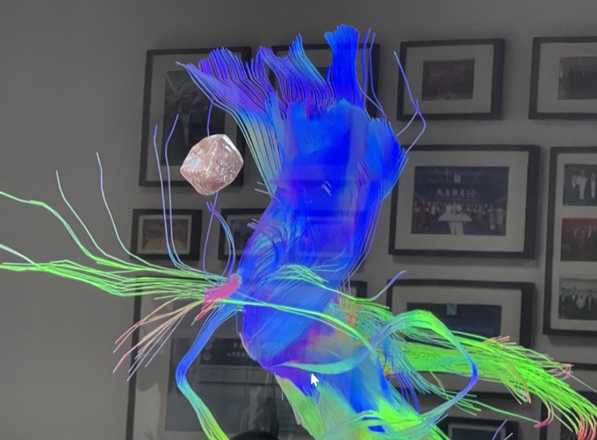 面对躁狂症要怎么办,面对双相情感障碍的人该怎么安慰