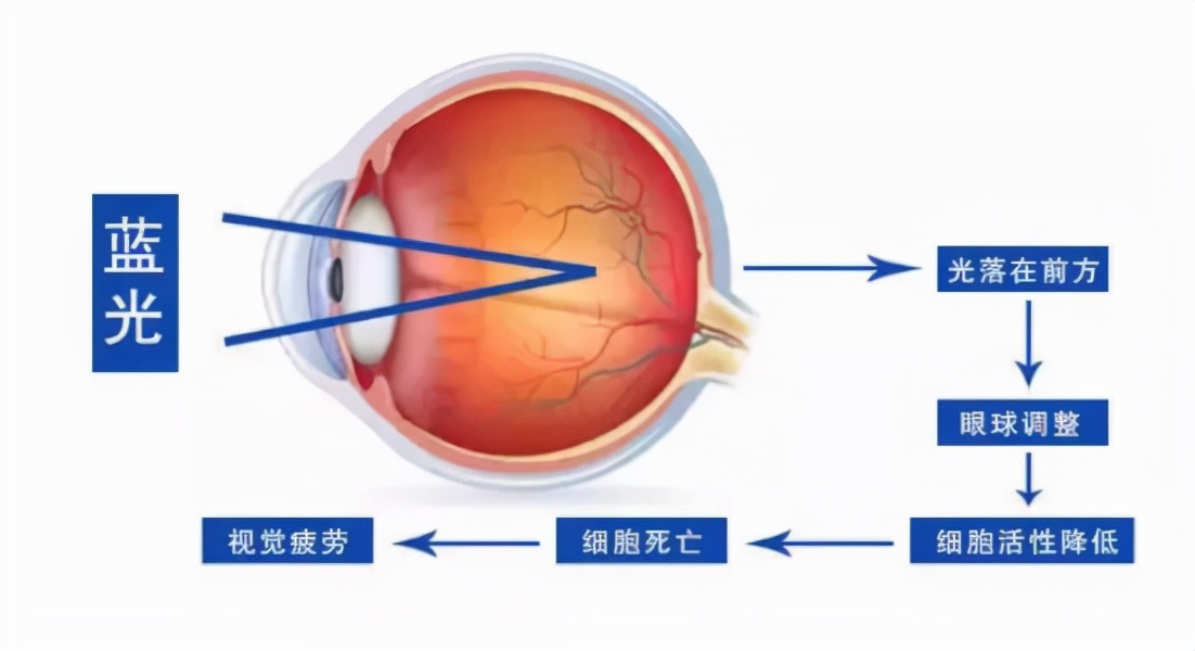 电视防蓝光和不防蓝光有什么区别,眼镜防蓝光的好还是不防蓝光的好
