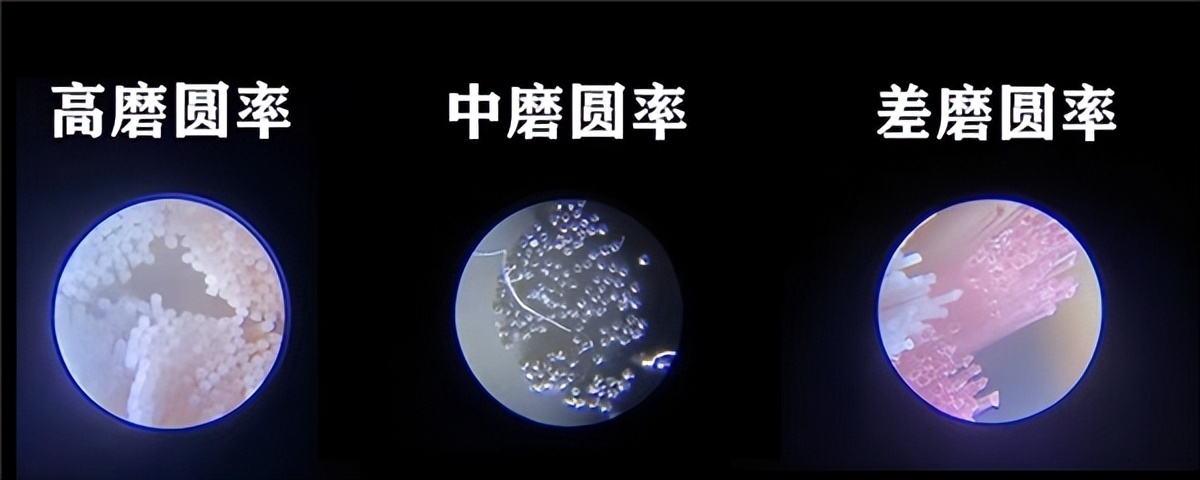 蛀牙如何防止牙齿继续蛀下去,蛀牙治疗后注意事项及饮食