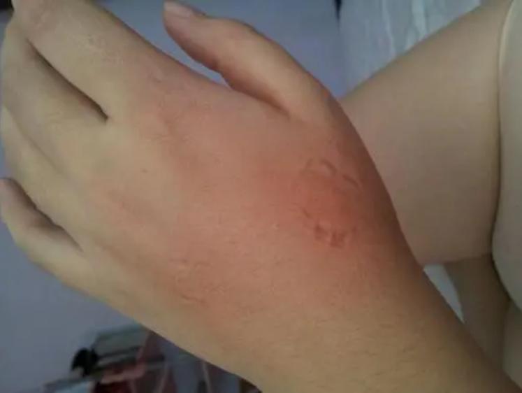 宝宝爱咬人爱抓人怎么办,宝宝喜欢咬人打人怎么纠正