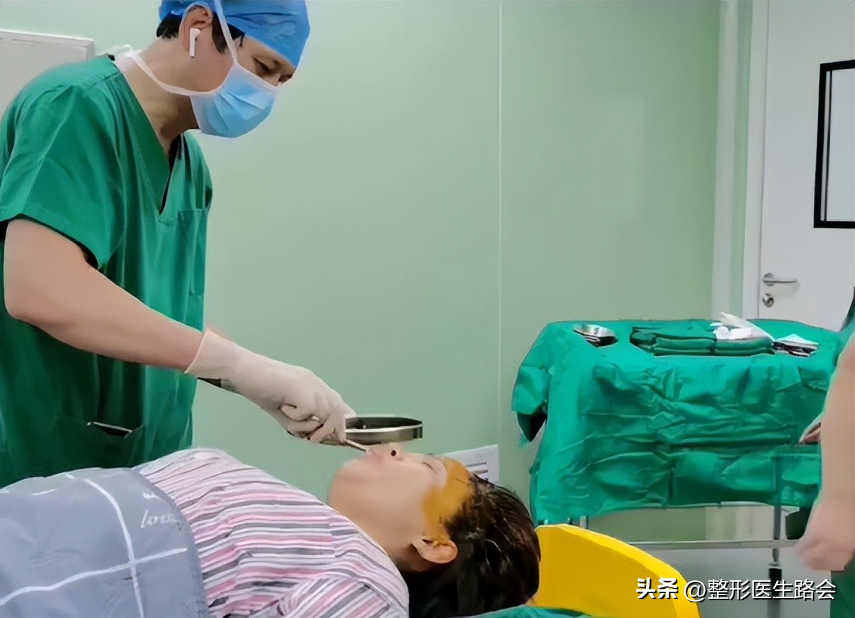 上海九院膨体填充太阳穴费用多少,膨体丰太阳穴视频全过程