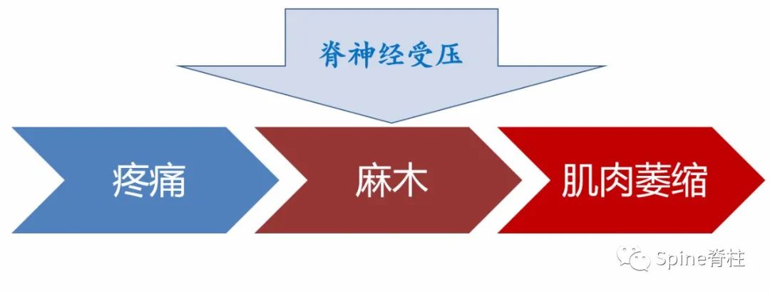 腰椎间盘突出症状表现,腰椎间盘突出症疼痛最佳止痛方法