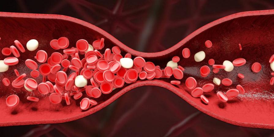 尿酸高的严重后果的视频,尿酸偏高身体会出现这几种症状