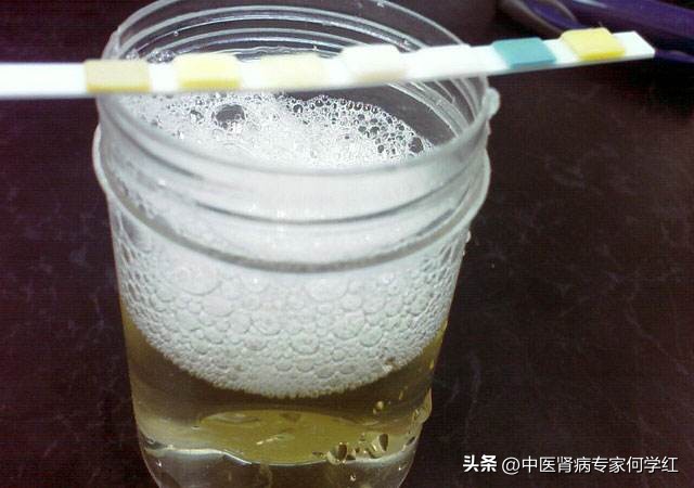 补肾降尿蛋白的中药有哪些,降尿蛋白中药方剂