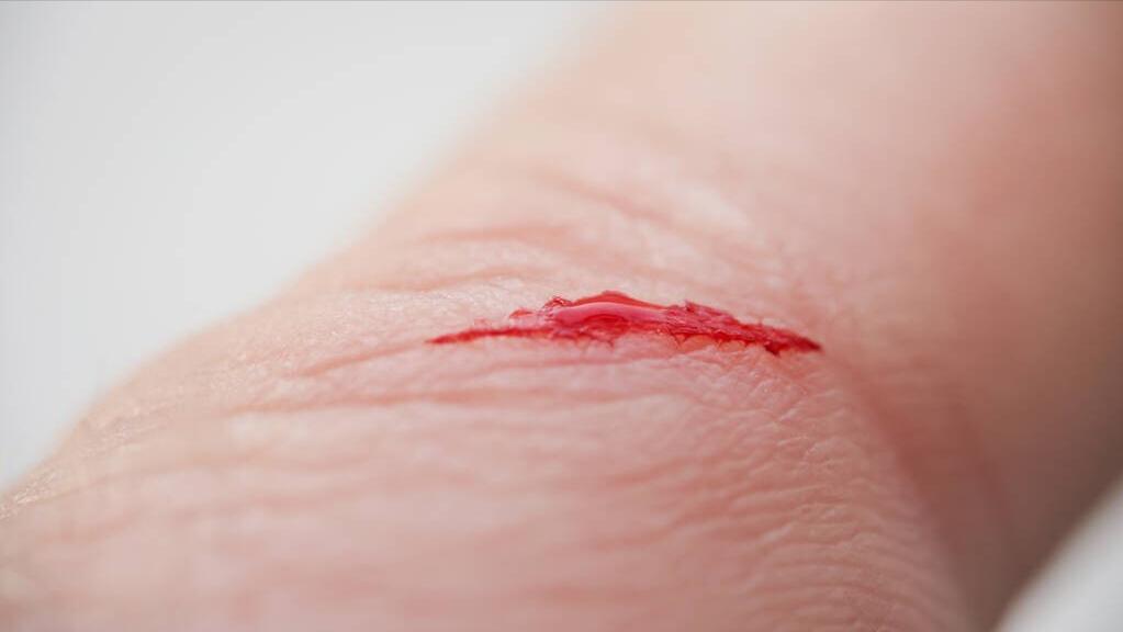 阿莫西林要认清楚，只对6种病有效！用对是个宝，用错是毒药