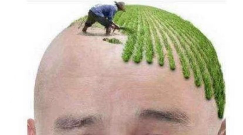 脱发脱得严重用什么防脱发,防脱要趁早改善脱发