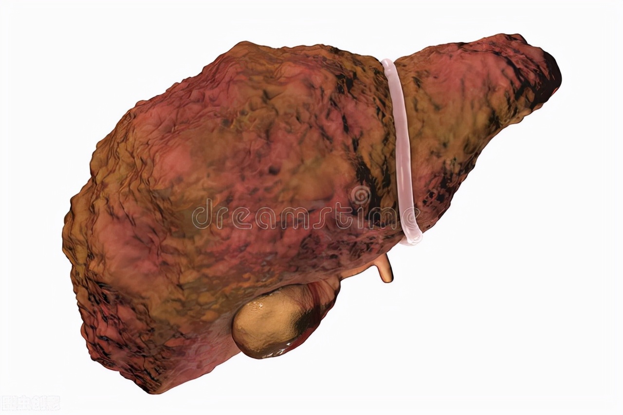 b超报告单肝实质回声增粗啥意思,b超检查发现肝回声粗是什么意思