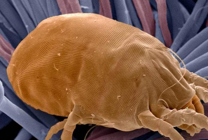 耳朵经常痒可能暗示3个问题,耳朵老是痒有什么预兆