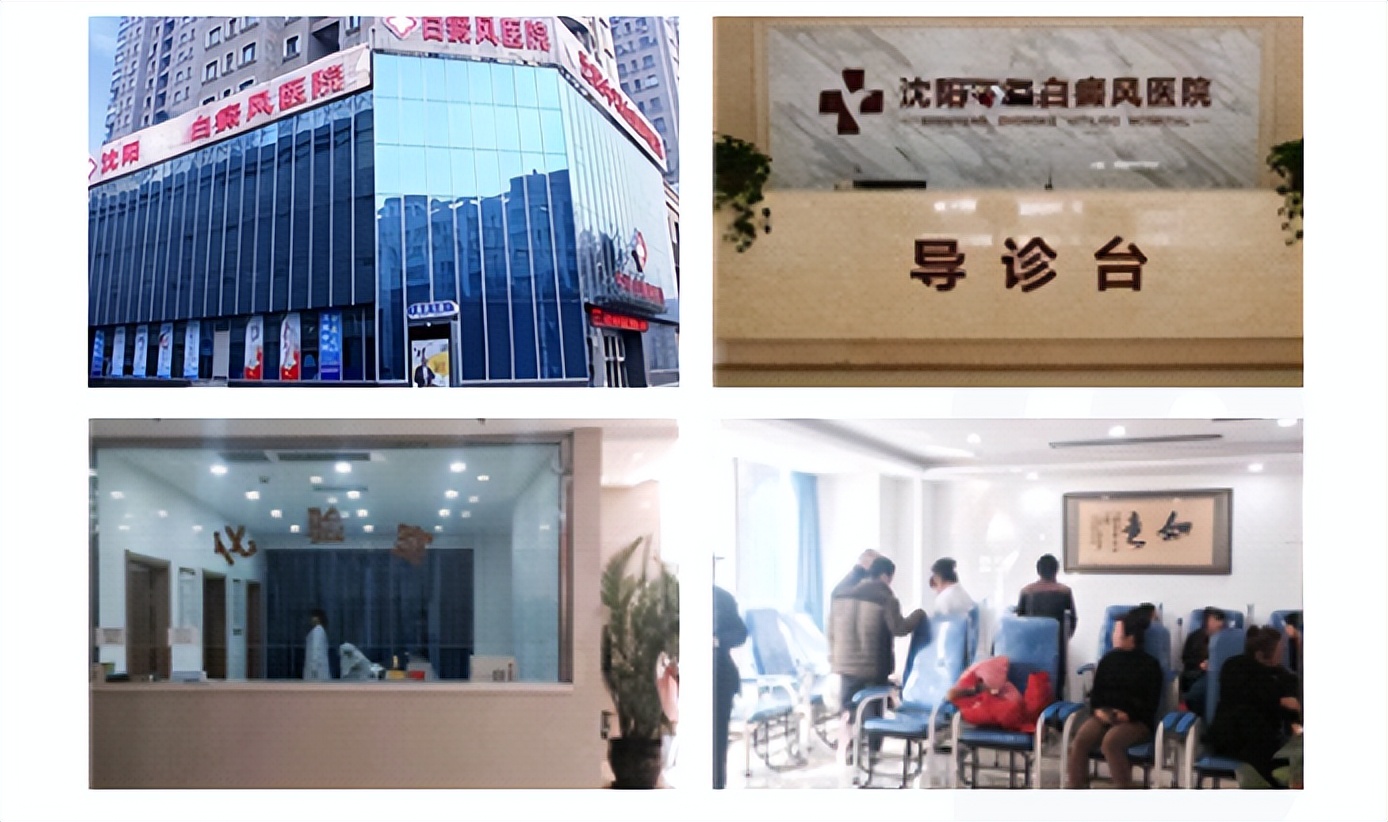 沈阳中医白癜风医院护士工资多少,白癜风皮肤病医院招聘