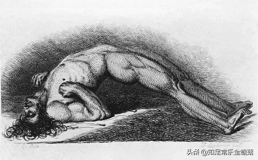 伤口碰到铁锈如何判断感染破伤风,伤口有铁锈得破伤风的几率有多大