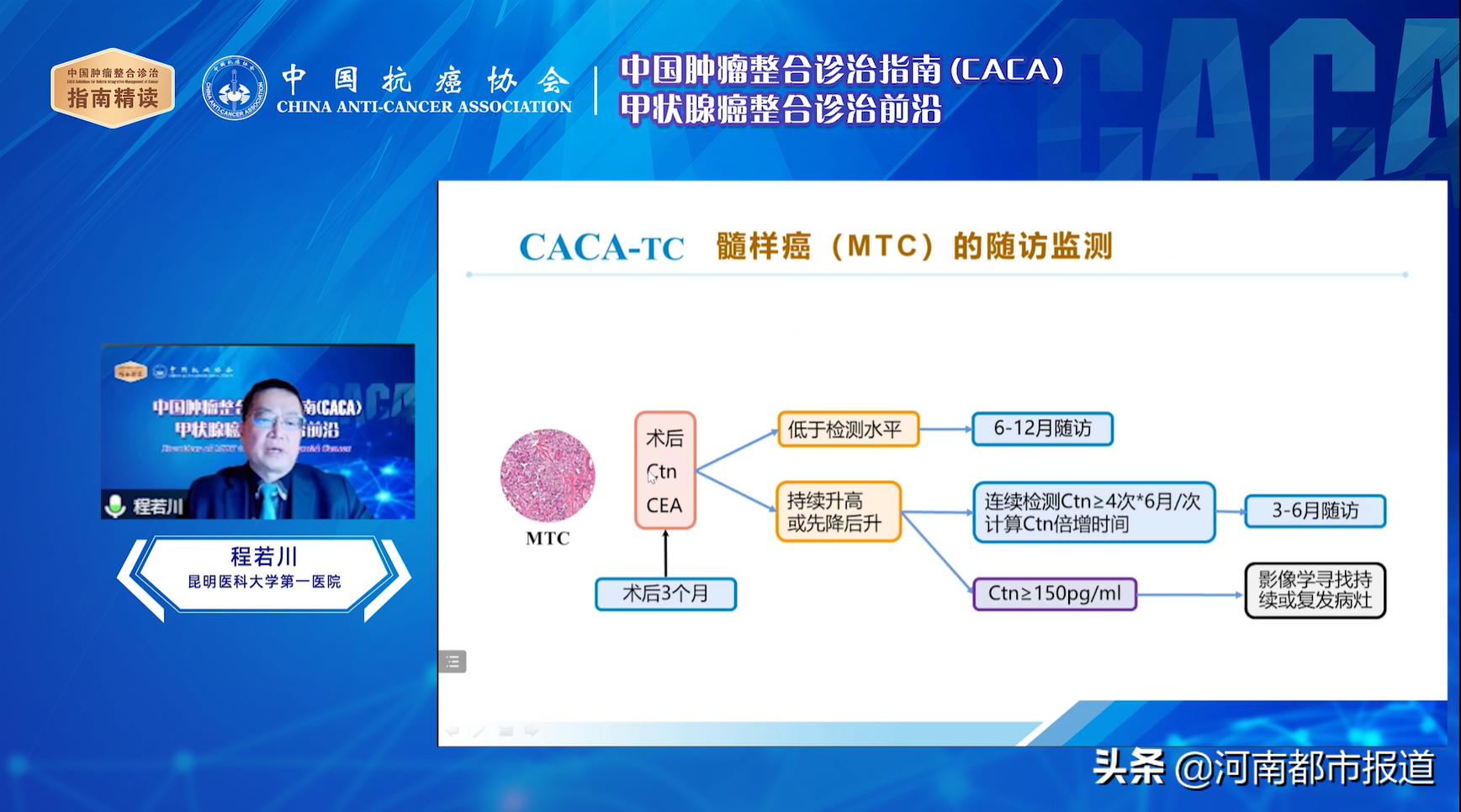 caca指南精读巡讲第14-19场,csco甲状腺癌指南