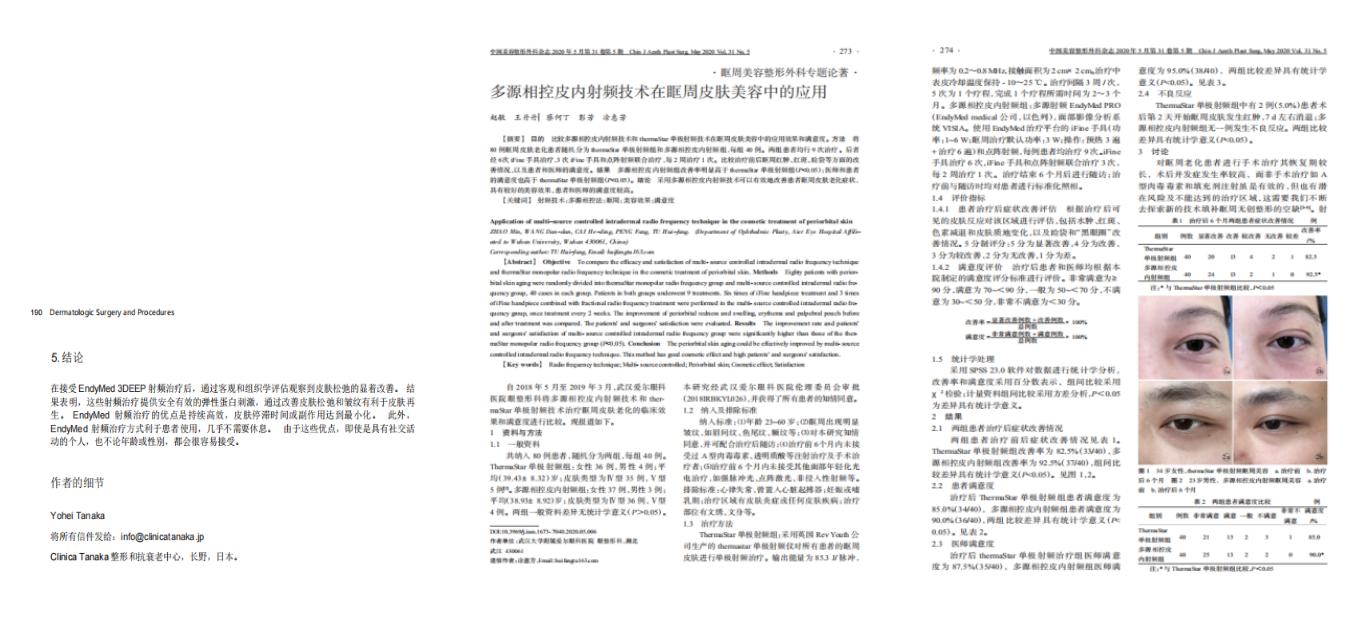 美迪迈相控微针是什么,美迪迈相控微针多久能化妆