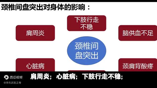 中医科普视频“人的支柱——脊柱·颈椎篇”岐德堂中医骨科出品