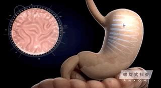 胃不舒服胃酸怎么缓解,大吃大喝过后怎么补救