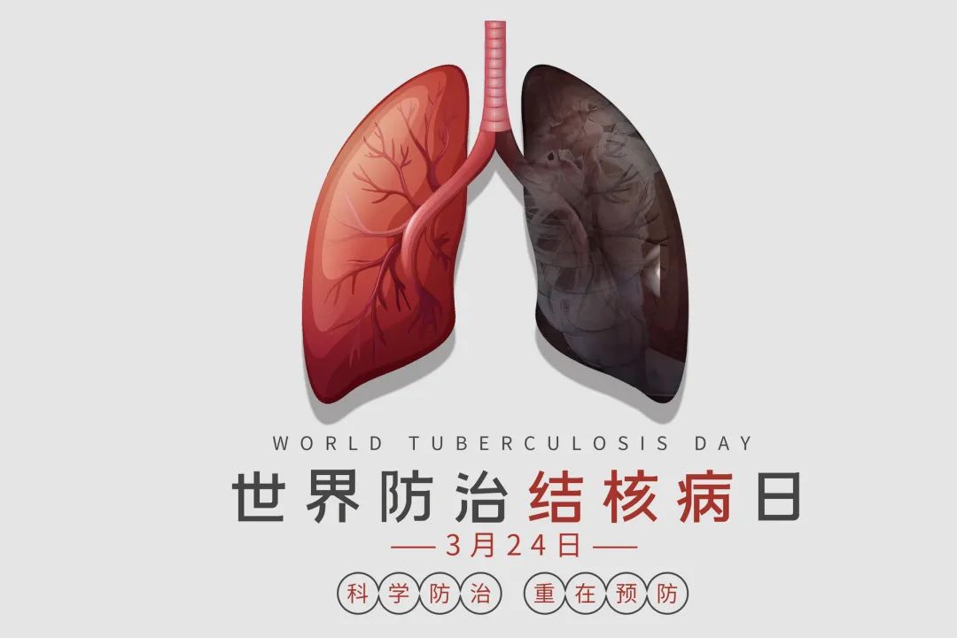 世界防治结核病日知识题库,世界防治结核病日科普