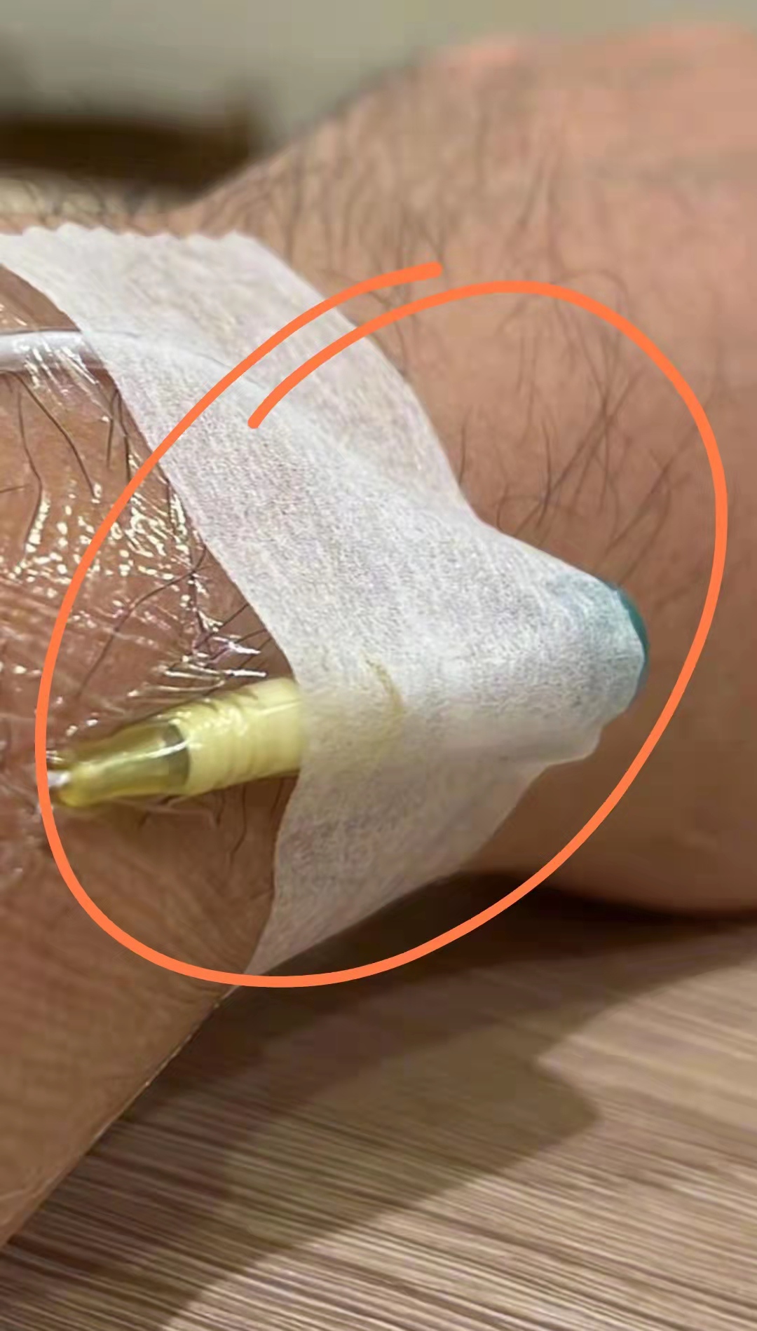 周杰伦疑因设备故障受伤事件,周杰伦身体不适就医