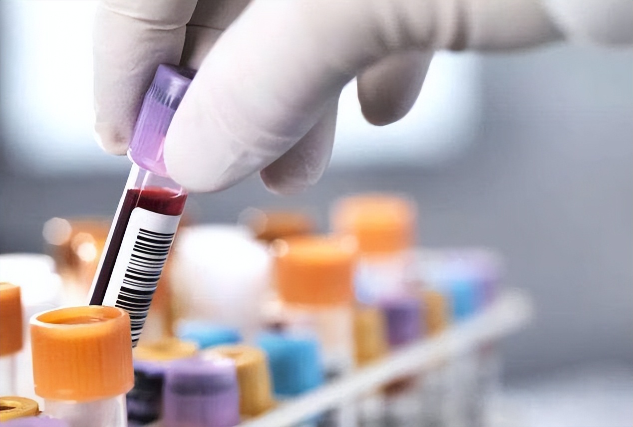 血常规哪些项目异常要警惕,血常规这几项异常一定要引起重视