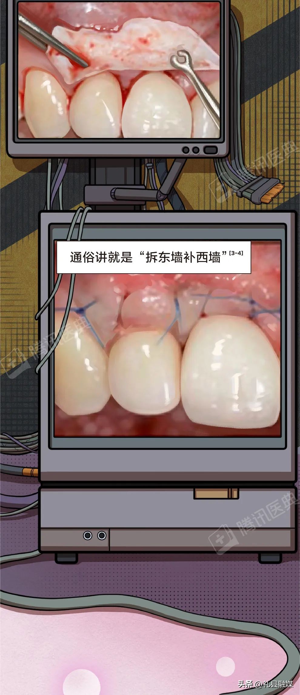 牙齿吃肉总是塞牙怎么治疗,吃肉吃菜老是塞牙怎么办