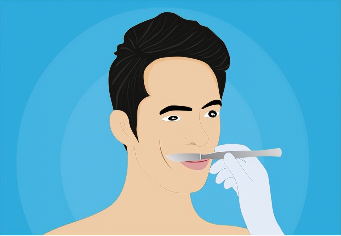 面肌痉挛会不从眼皮开始发病吗,什么是面肌痉挛该如何治疗