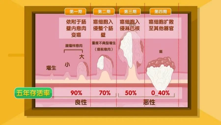 社区直肠癌筛查怎么查的,结直肠癌万人社区筛查项目