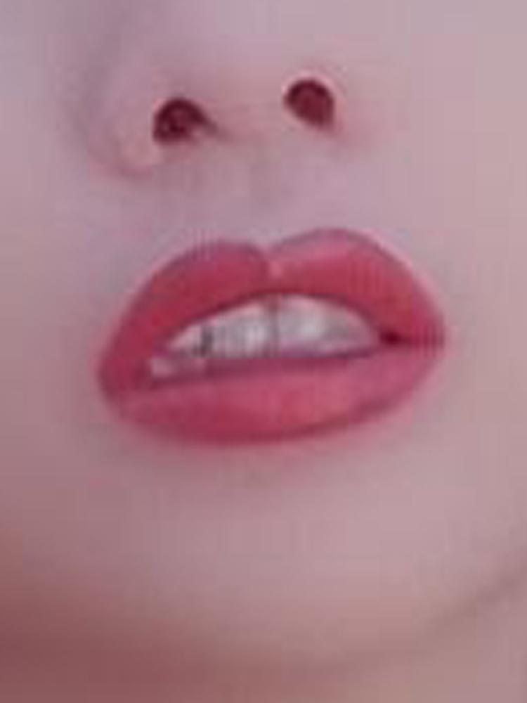 龅牙凸嘴,龅牙凸嘴露牙龈