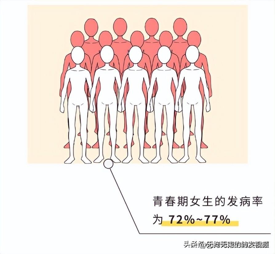 屁股上有白色条纹,屁股上都是白色条纹