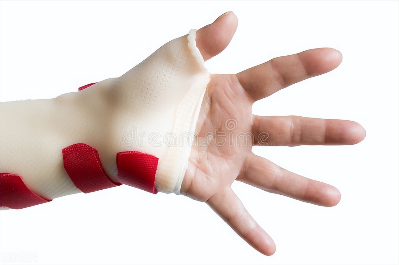 儿童手指伸不直需要矫正器吗,腱鞘炎手指伸不直怎么办