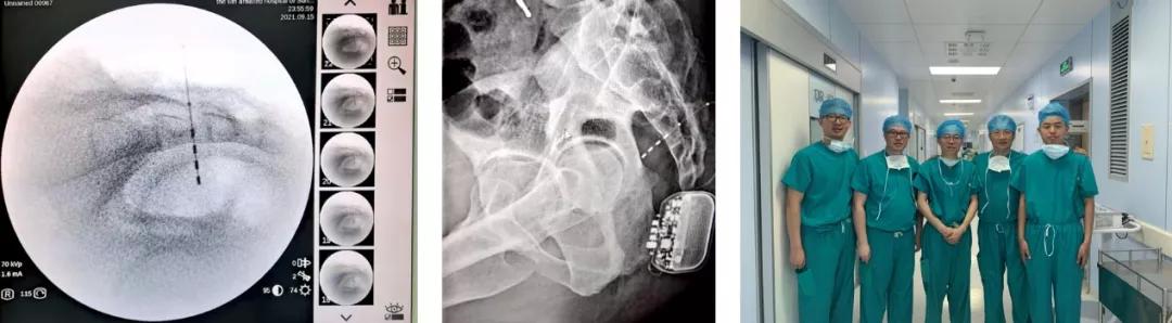 中山六院的肛肠外科在全国怎么样,中山六院肛肠专科医院