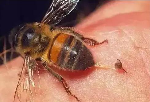 蜂蜇伤最好的处理方法,蜂蜇伤怎么处理