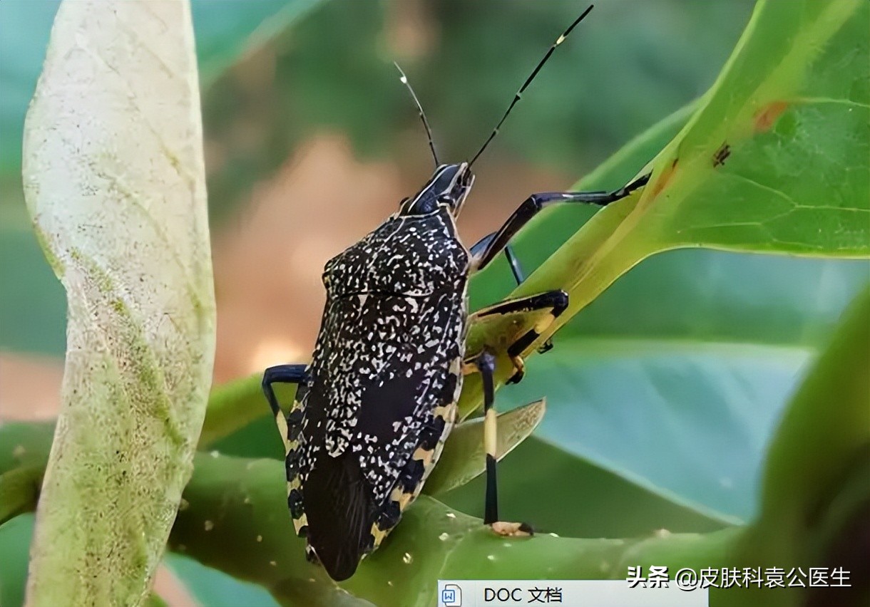 蚊虫叮咬引起的皮炎一年了没好,夏季有哪些虫叮咬会红肿