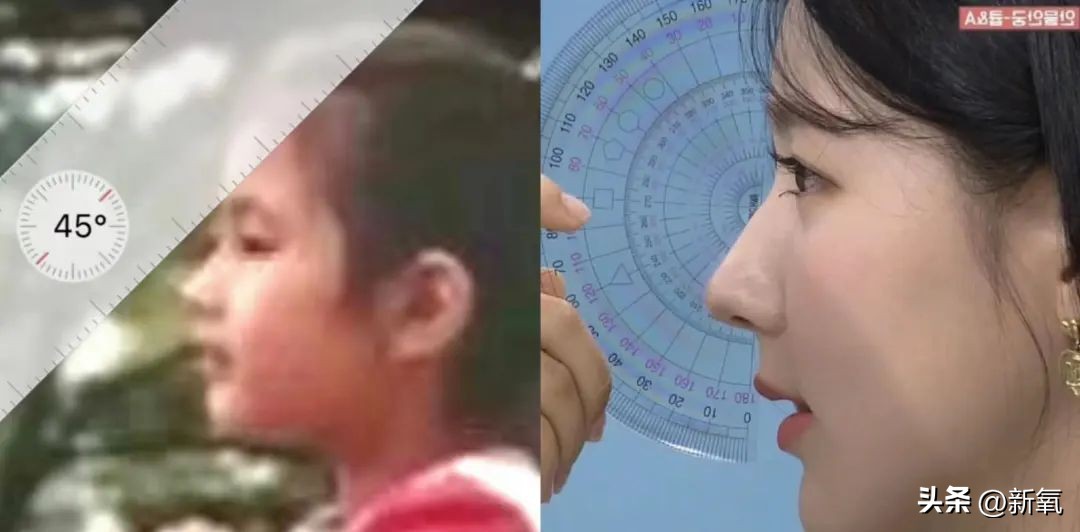 改一点赢很大？她整完鼻子直接美成断代神颜…