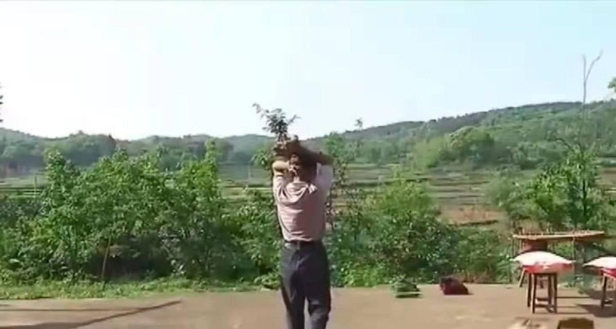 男子手长满树疙瘩是什么病,男子手长满树疙瘩手术了吗