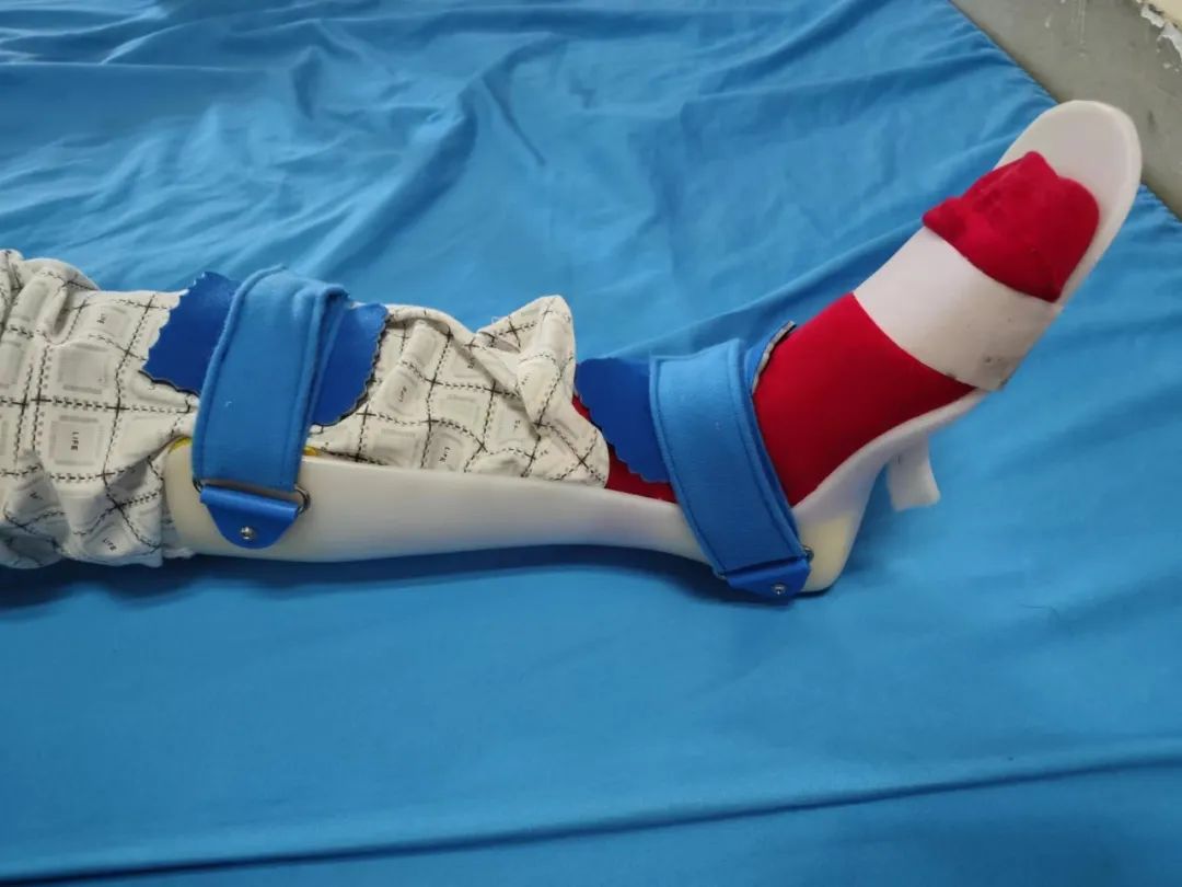 偏瘫左腿走路画圈怎样练习,偏瘫脚画圈怎么康复治疗