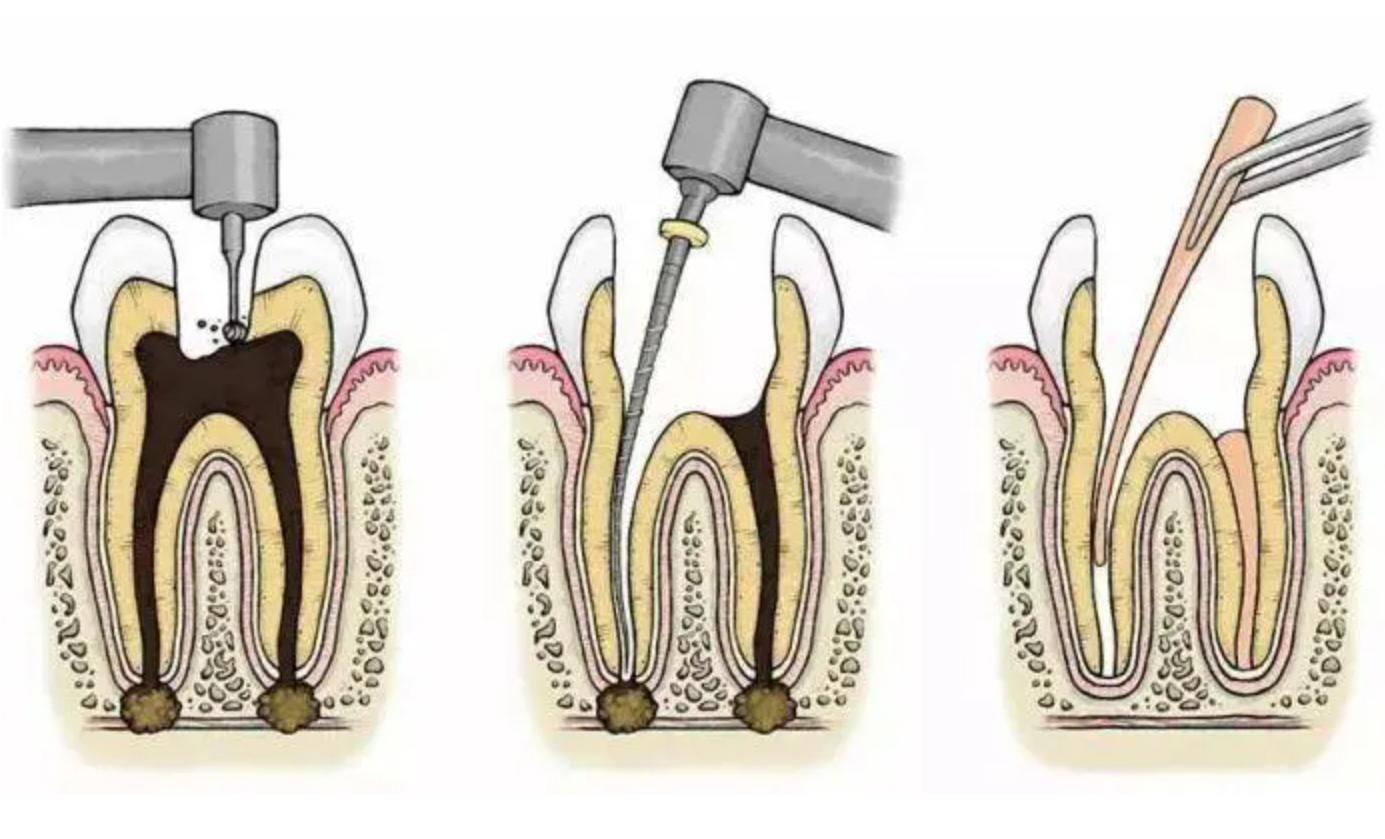 米家声波电动牙刷t700测评,米家声波电动牙刷t501c评测
