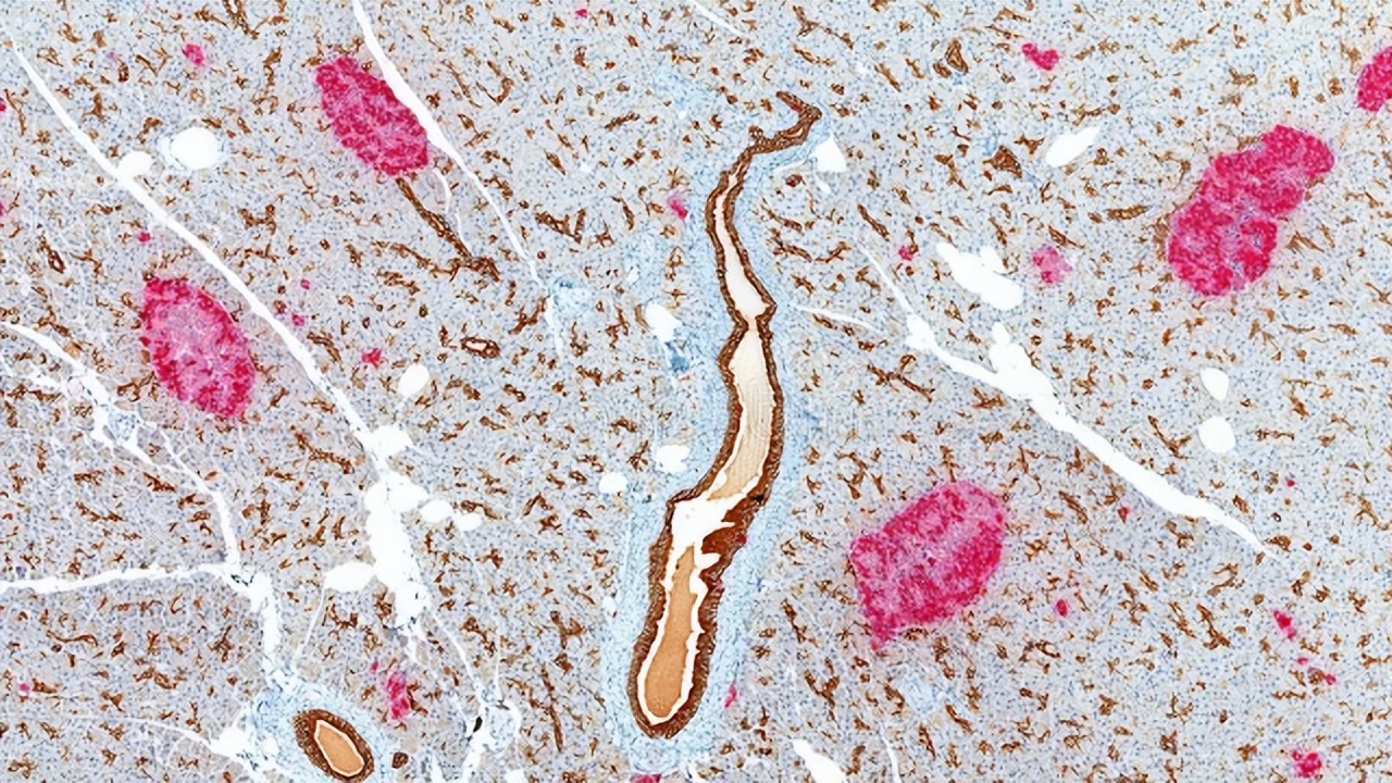 患糖尿病之后,性功能越来越差是怎么回事?医生告诉你明确答案