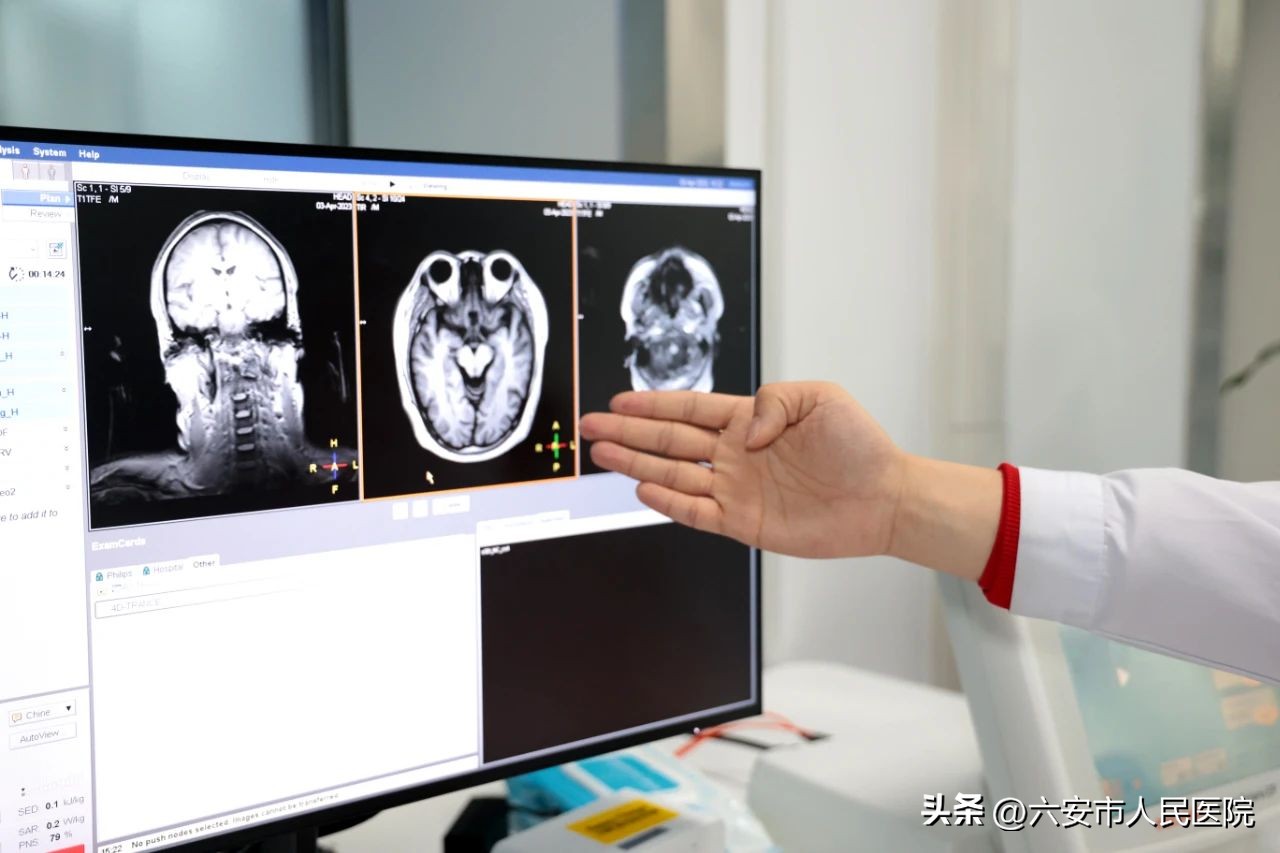 重磅！PHILIPSINGENIA3.0TCX磁共振在六安市人民医院西院区启用