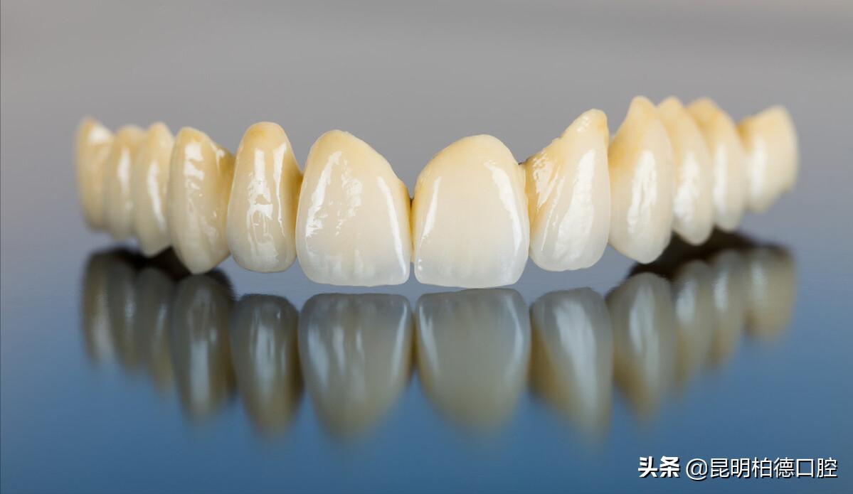 烤瓷冠牙龈变黑,全瓷冠边缘发黑怎么回事